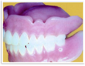 シリコン床義歯